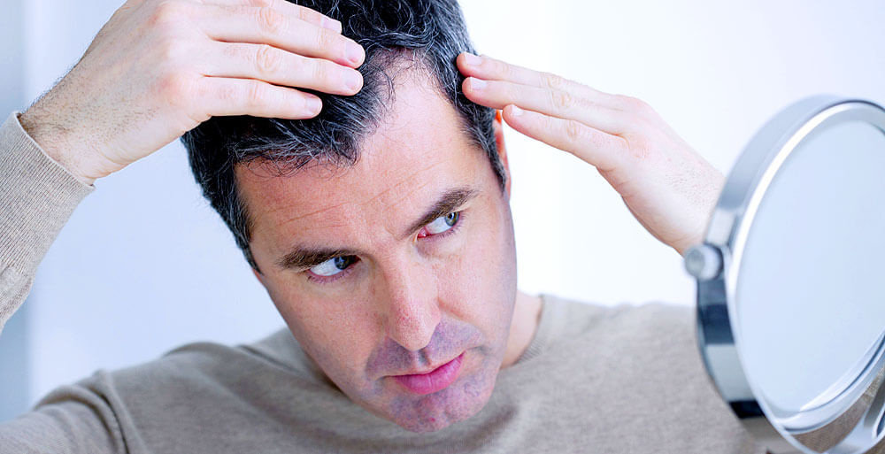 Die Ursache für männlichen Haarausfall ist genetisch 