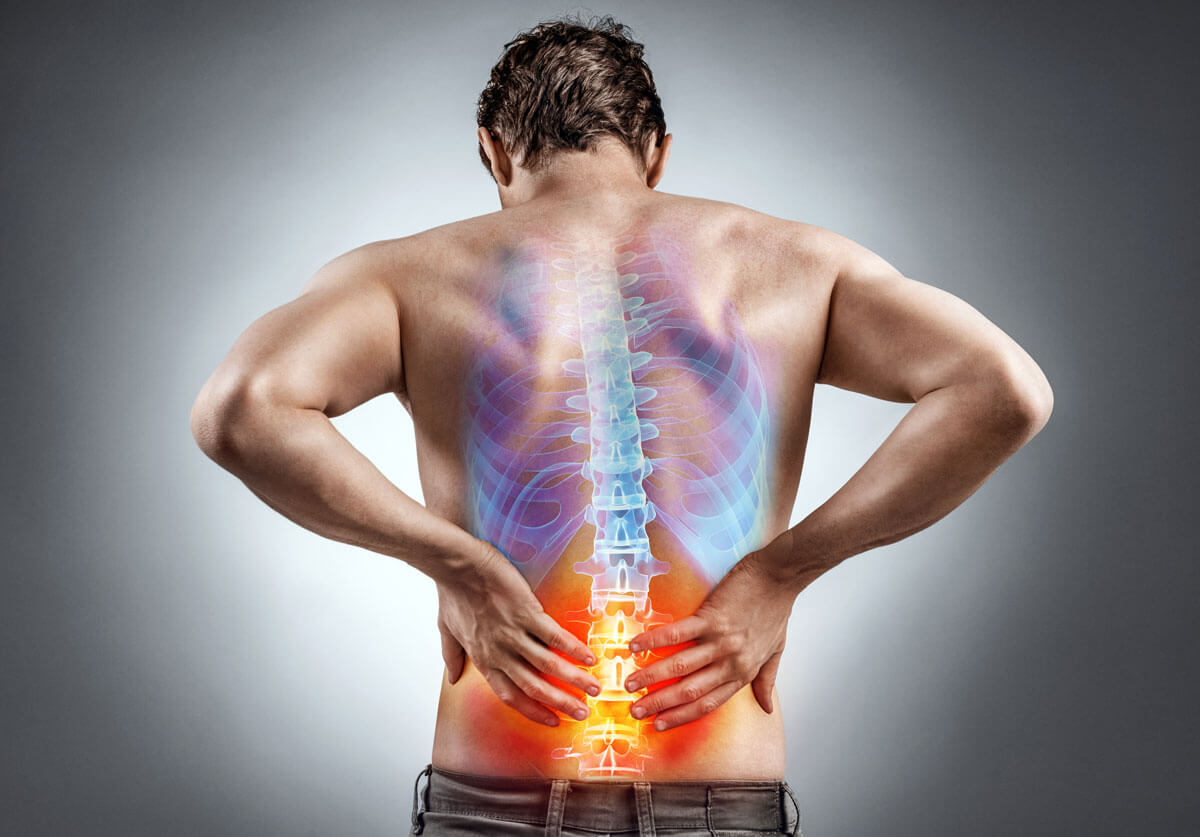 Rückenschmerzen können viele Ursachen haben