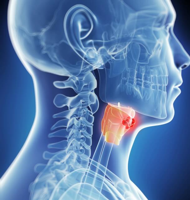 Kehlkopfkrebs Symptome Typische Anzeichen Erkennen Was Tun