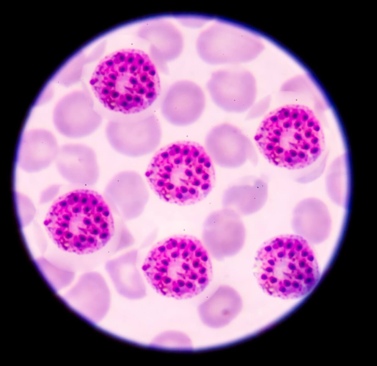Malaria unter dem Mikroskop 